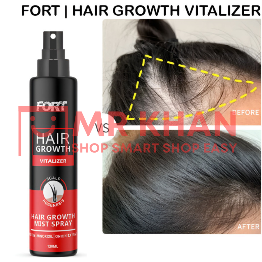 FORT Minoxidil Hair Growth Spray
