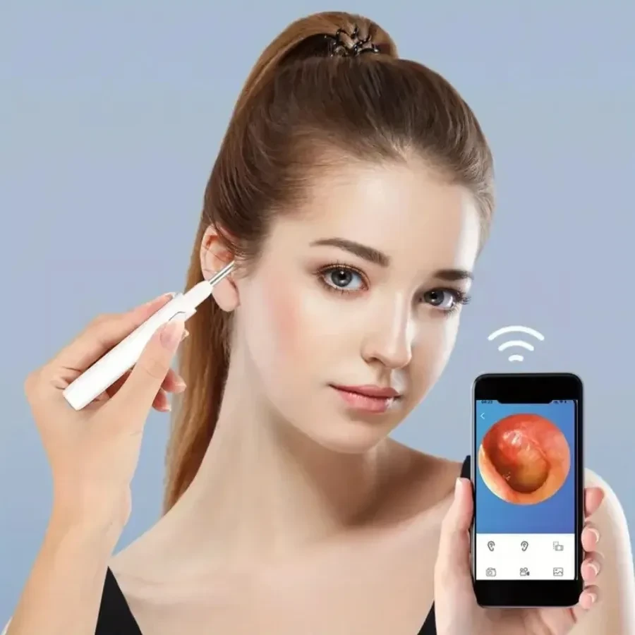 Smart Ear Wax Removal Tool with Visual Otoscope –